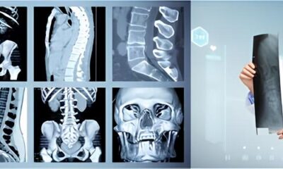 Um Raio X no Futuro da Medicina Concurso na Unicamp Revela Oportunidades Inovadoras em Radiologia Diagn stica e Terap utica